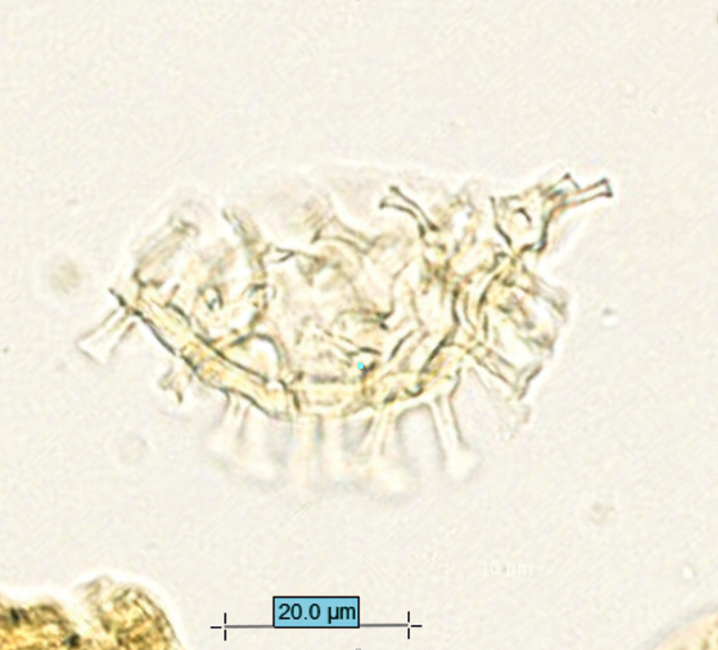 Dinocyst i mikroskop